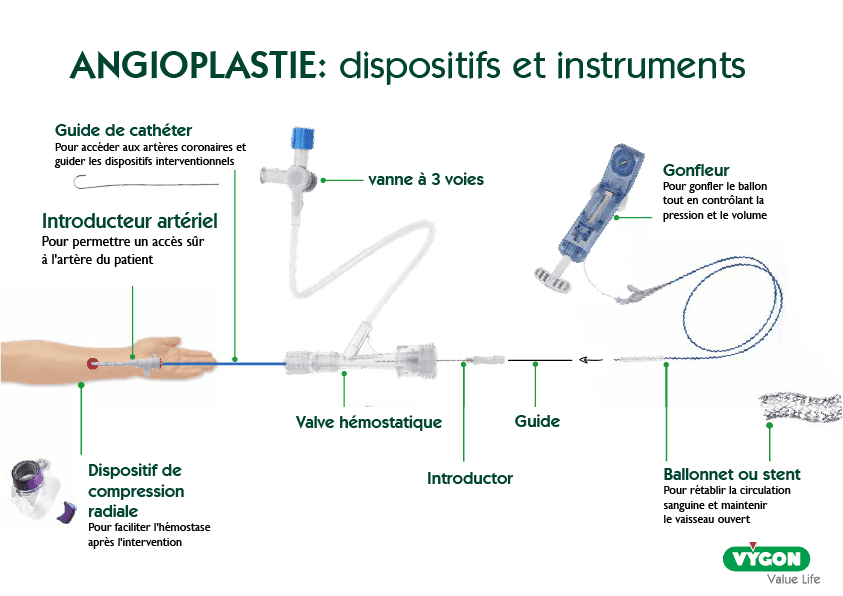 Infographie présentant les dispositifs et instruments utilisés en angioplastie. Inclut guide de cathéter pour accéder aux artères coronaires, introducteur artériel pour un accès sécurisé, dispositif de compression radiale pour faciliter l’hémostase, vanne à 3 voies, valve hémostatique, introducteur, guide, gonfleur pour contrôler la pression et le volume du ballon, ainsi que ballonnet ou stent pour rétablir la circulation sanguine et maintenir le vaisseau ouvert. Conçu pour les professionnels de santé pratiquant l’angioplastie.