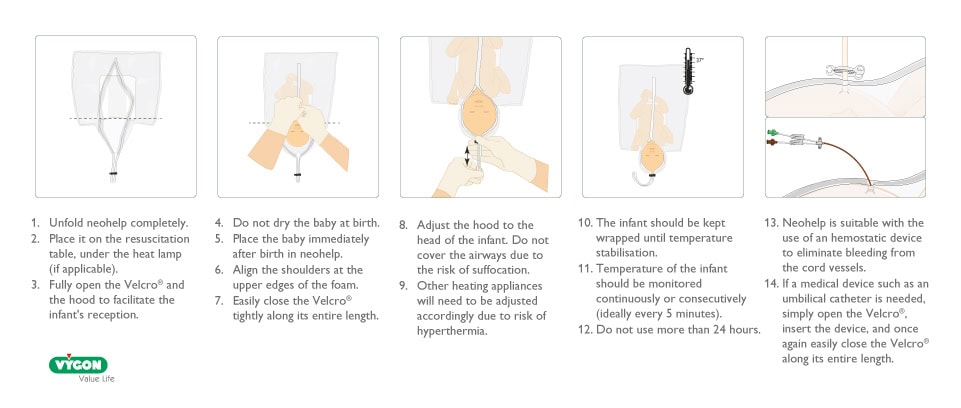 Step‑by‑step instructional diagram showing how to use Polyethylene Occlusive Suits for neonates, including unfolding the suit on the resuscitation table, placing the newborn immediately after birth, aligning the shoulders with the foam edges, adjusting the hood without covering the airway, securing the Velcro closure, maintaining thermal stabilization, monitoring temperature regularly, and opening the device easily for medical procedures such as catheter insertion while preserving heat.