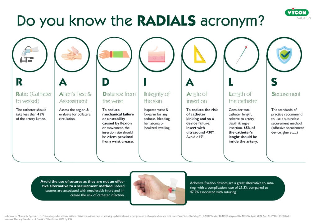 radial arterial catheterization
