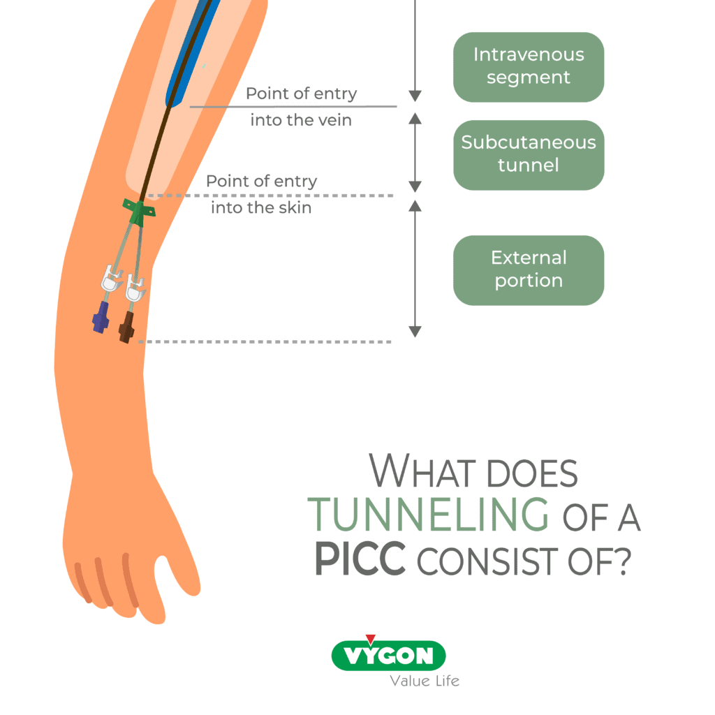 What-does-tunneling-of-a-PICC-consist-of