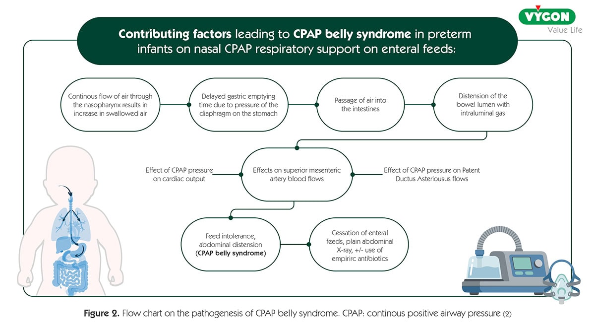 Flow chart on the pathogenesis of CPAP belly syndrome Infographic explaining the contributing factors and pathogenesis of CPAP belly syndrome in preterm infants on nasal CPAP respiratory support and enteral feeding. The diagram outlines the relationship between swallowed air, delayed gastric emptying, intestinal gas accumulation, bowel distension, altered blood flow, feeding intolerance, and abdominal distension. Educational neonatal care graphic focused on respiratory support complications in premature babies.