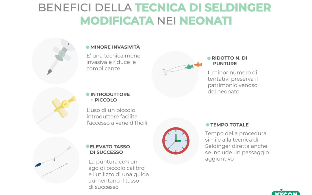 Benefici della tecnica di Seldinger Modificata nei neonati
