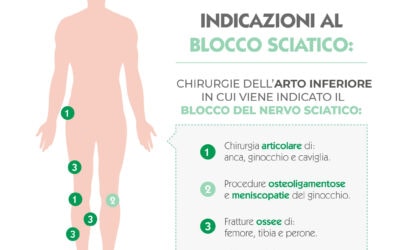 Indicazioni al Blocco del Nervo Sciatico