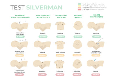 La scala di silverman per la valutazione del distress respiratorio nel neonato