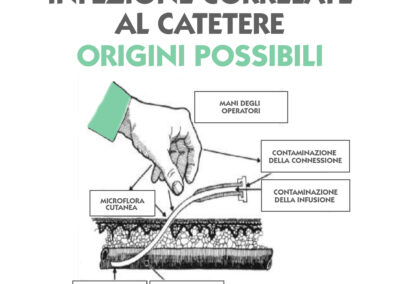 Infezione correlate al catetere
