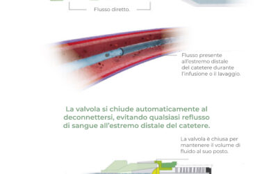 Connettori needleless: valvole antiriflusso