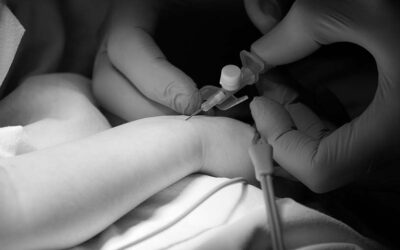 Come riconoscere ed evitare lo smorzamento nella forma d’onda della pressione arteriosa 