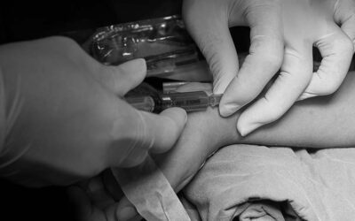 In cosa consiste e come evitare la risonanza nella forma d’onda della pressione arteriosa 