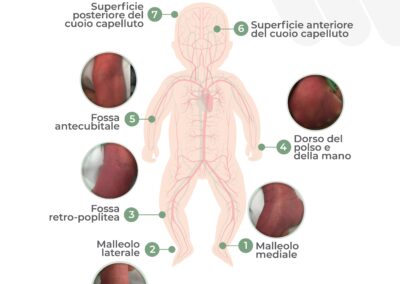 Valutazione delle vene superficiali del neonato