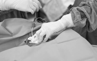 9 vantaggi dell’incannulamento venoso centrale tramite la tecnica dell’ecg intracavitario