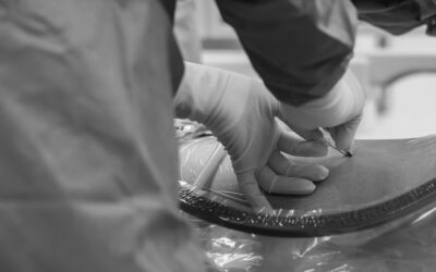 BLOCCO DI FASCIA: introduzione ai blocchi della parete toracica