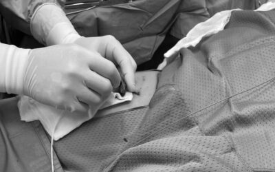 Conosci i FICC PORT? Una valida alternativa al PORT Brachiale