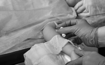 Le indicazioni dei CVC a breve termine nei pazienti pediatrici