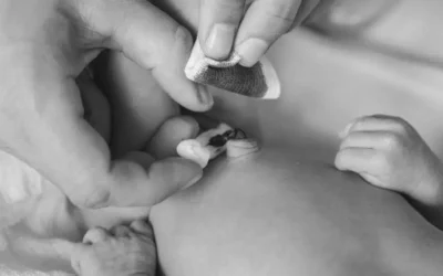 Cuidado del cordón umbilical en Neonatología