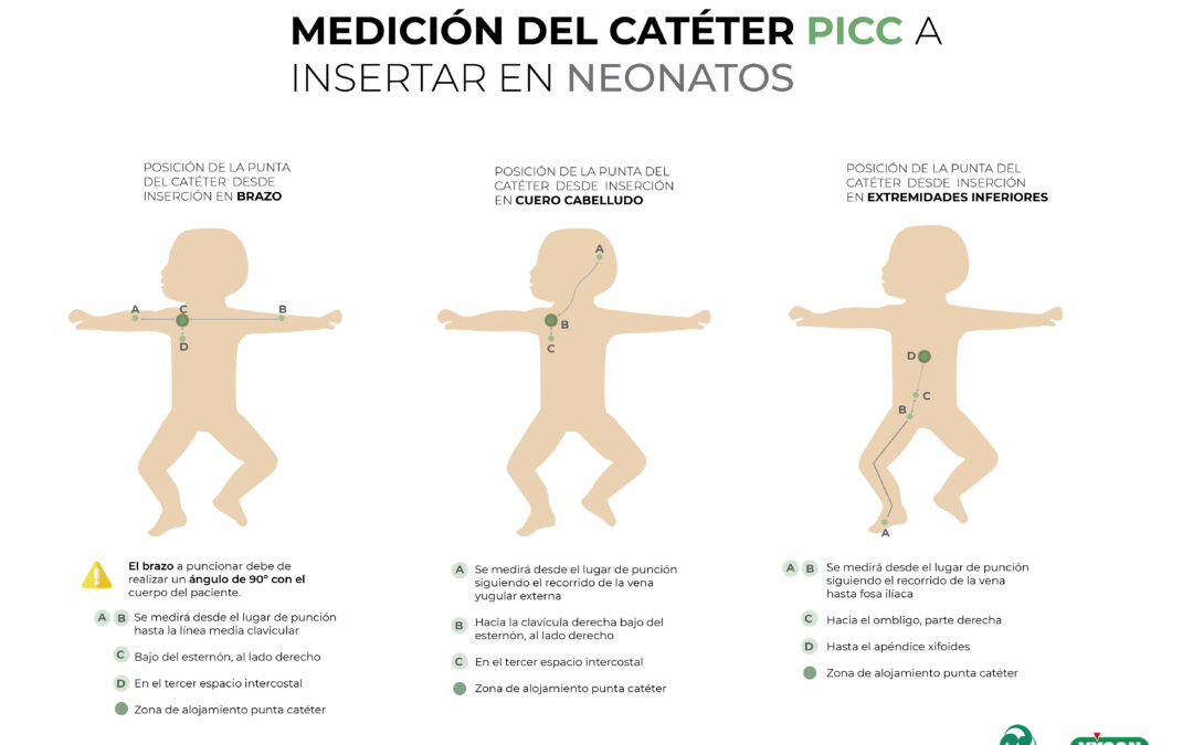 Medición del catéter PICC a insertar en neonatos