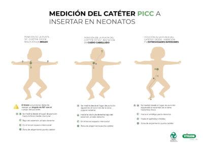 Medición del catéter PICC a insertar en neonatos