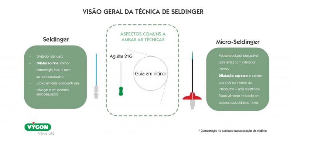 Técnica de Seldinger: quando utilizar o método clássico ou o método modificado 3 Infografia comparativa entre a técnica de Seldinger e a técnica Micro Seldinger na colocação de cateteres.