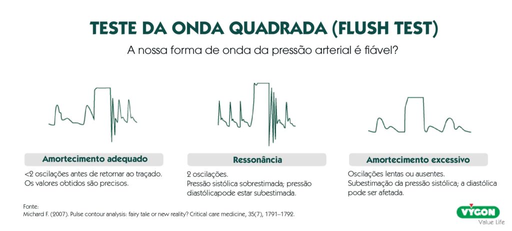 Teste da onda quadrada para avaliar ressonância e amortecimento na forma de onda da pressão arterial invasiva.