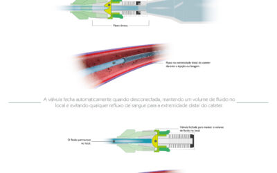 Como funciona um dispositivo anti‑refluxo