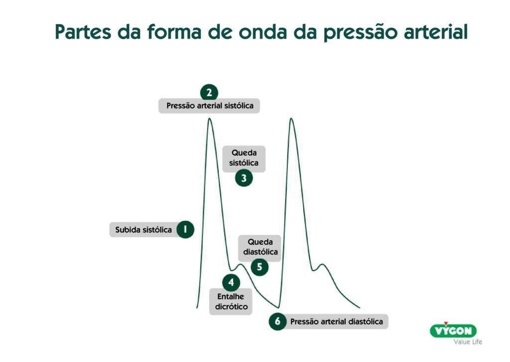 Partes da forma de onda da pressão arterial e impacto da ressonância na forma de onda da pressão arterial.