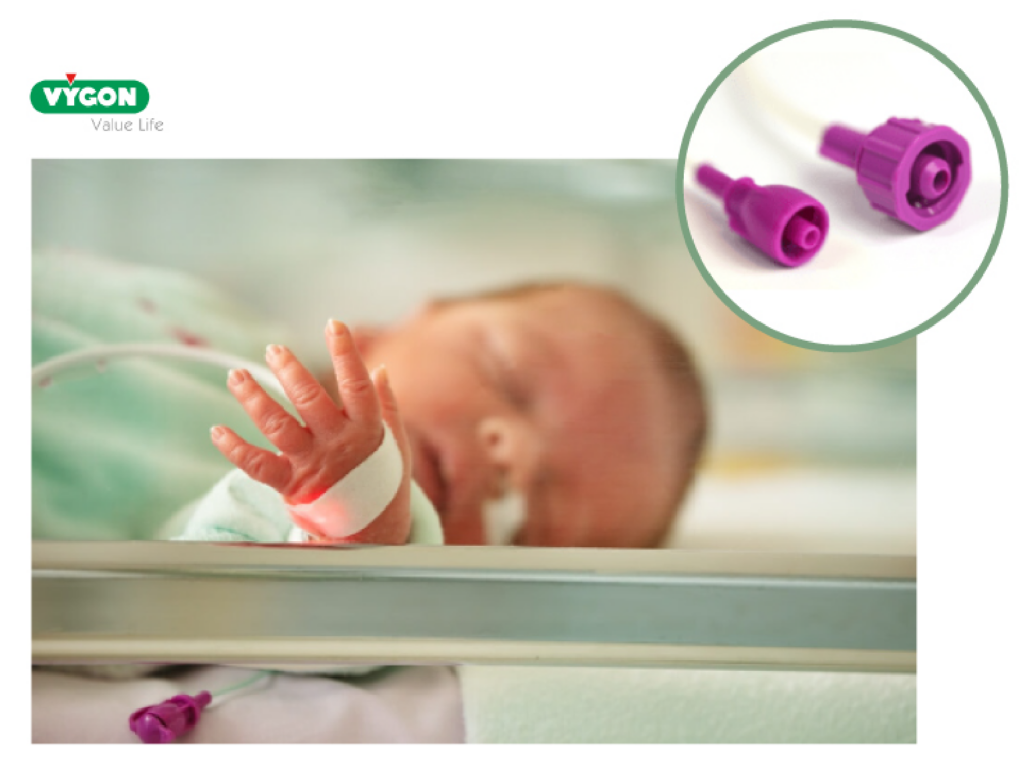 Conectores ENFit™ em neonatologia utilizados em recém-nascidos para administração de nutrição enteral.
