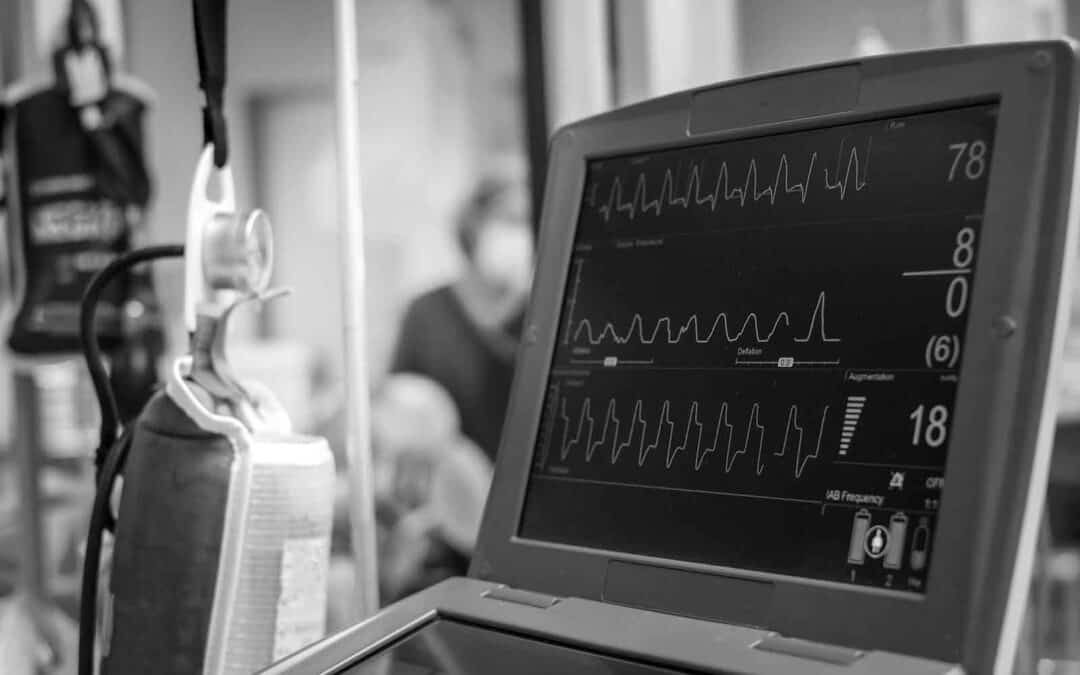 Resumo ciêntifico: “Concordância da análise da onda de pulso minimamente invasiva na monitorização do débito cardíaco com medições por termodiluição da artéria pulmonar e transpulmonar em medicina perioperatória e cuidados intensivos: revisão sistemática e meta‑análise”