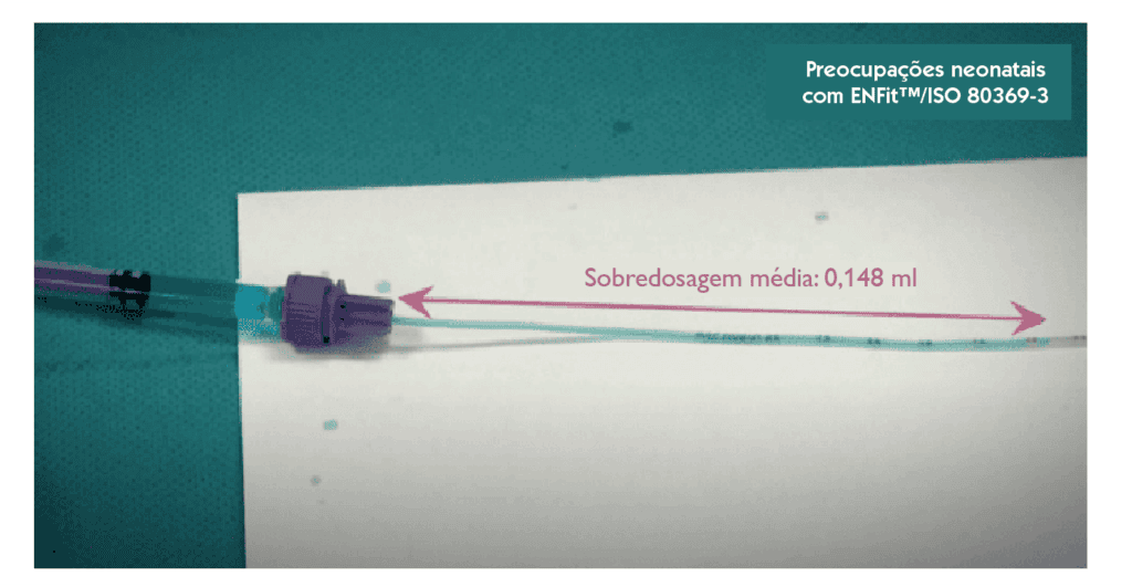 Exemplo de sobredosagem associada a conector ENFit, com deslocamento de volume durante a administração de fármacos.