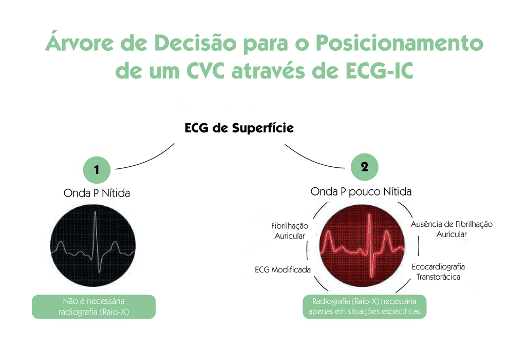 Árvore de decisão para posicionamento de CVC através de ECG intracavitário