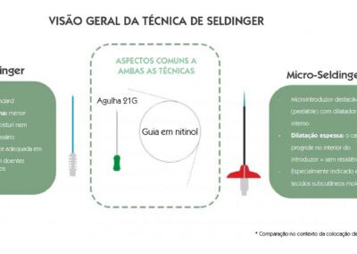 Visão geral da técnica de Seldinger