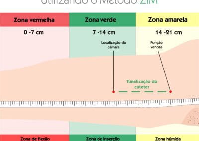 Tunelização utilizando o método ZIM
