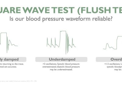 4 keys to avoid resonance in the blood pressure waveform