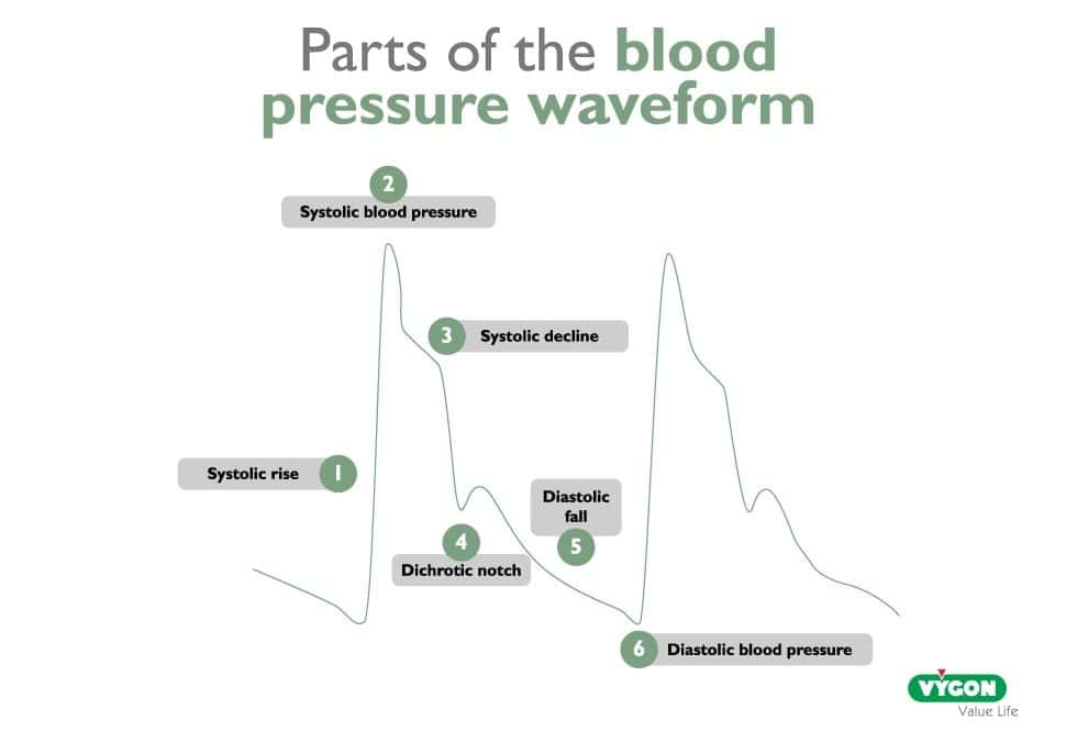 Parts of the blood pressure waveform