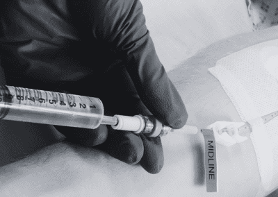 Economic Impact of Venous Catheters: Cost Comparison Study