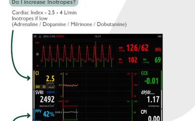 Managing Hypotension – Inotropes or fluids