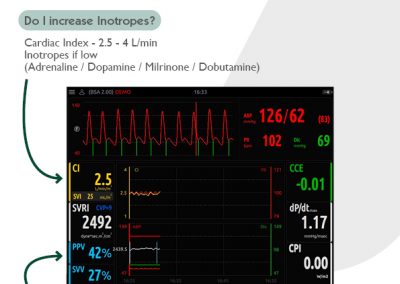 Managing Hypotension – Inotropes or fluids