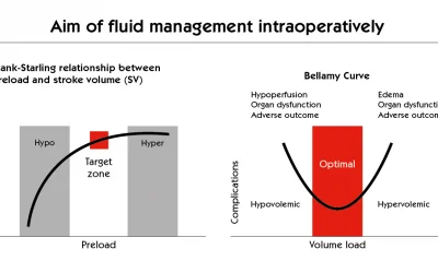 The Aim of Fluid Management Intraoperatively