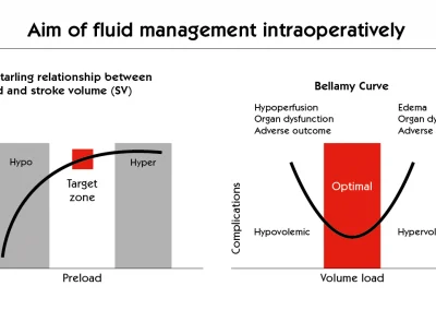 The Aim of Fluid Management Intraoperatively