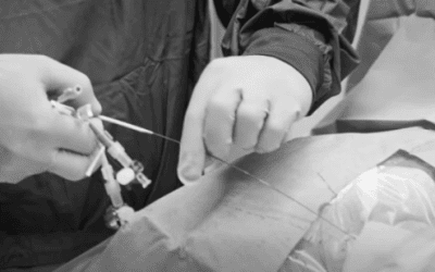 Keys to Central Venous Line (CVC) Maintenance