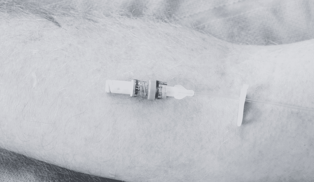 Bionector TKO Clinical Brochure