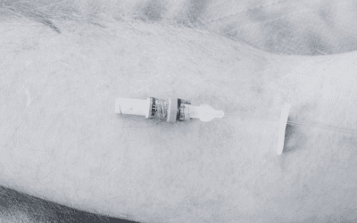 Bionector TKO Clinical Brochure