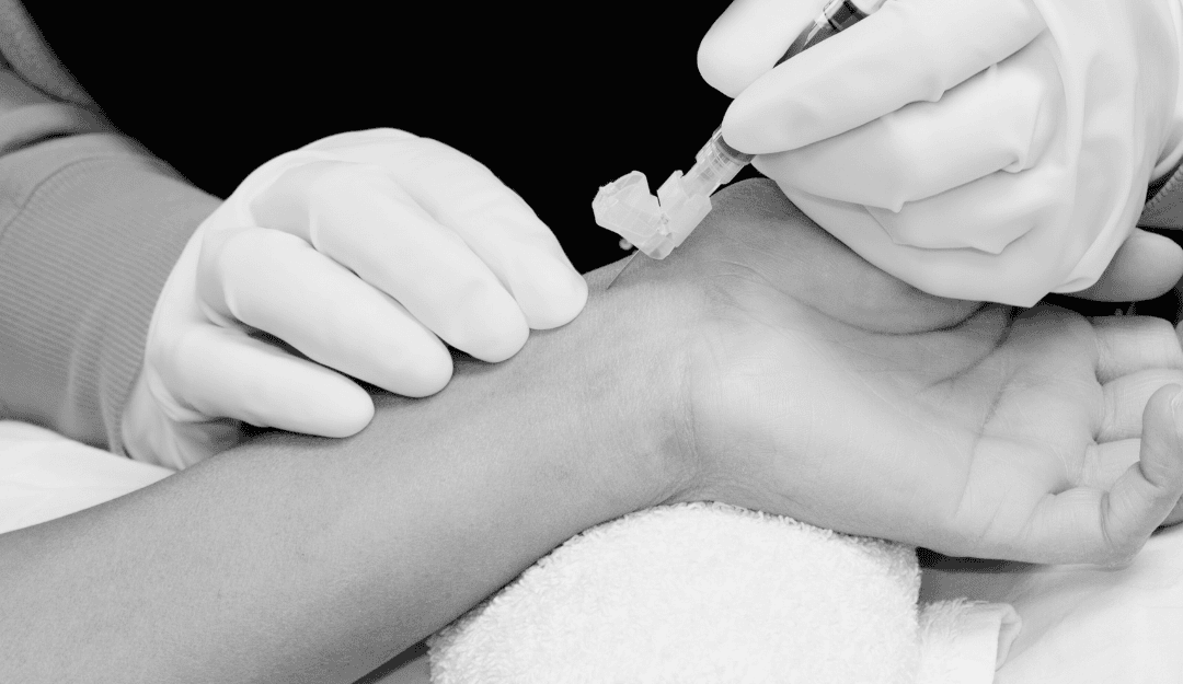 8 Complications That Can Occur During Arterial Cannulation