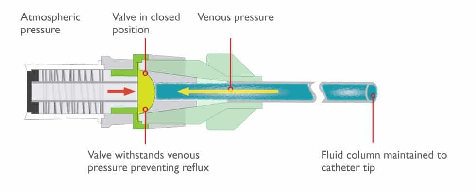 Bi Directional Terminators The Importance of Using a Needle Free Connector with a Bi-directional ...