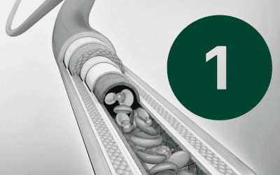 Article 1: The Expanding Role of Nurses in Arterial Line Placement