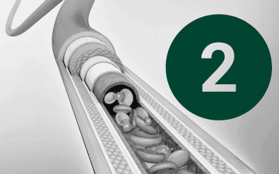 Article 2: Anatomy & Site Selection – Getting the Basics Right