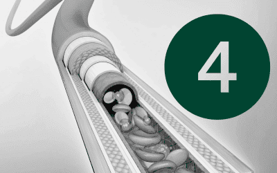 Article 4: Patient Assessment & Consent – A Critical First Step