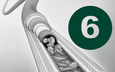 Article 6: Complications – Prevention, Recognition, and Management