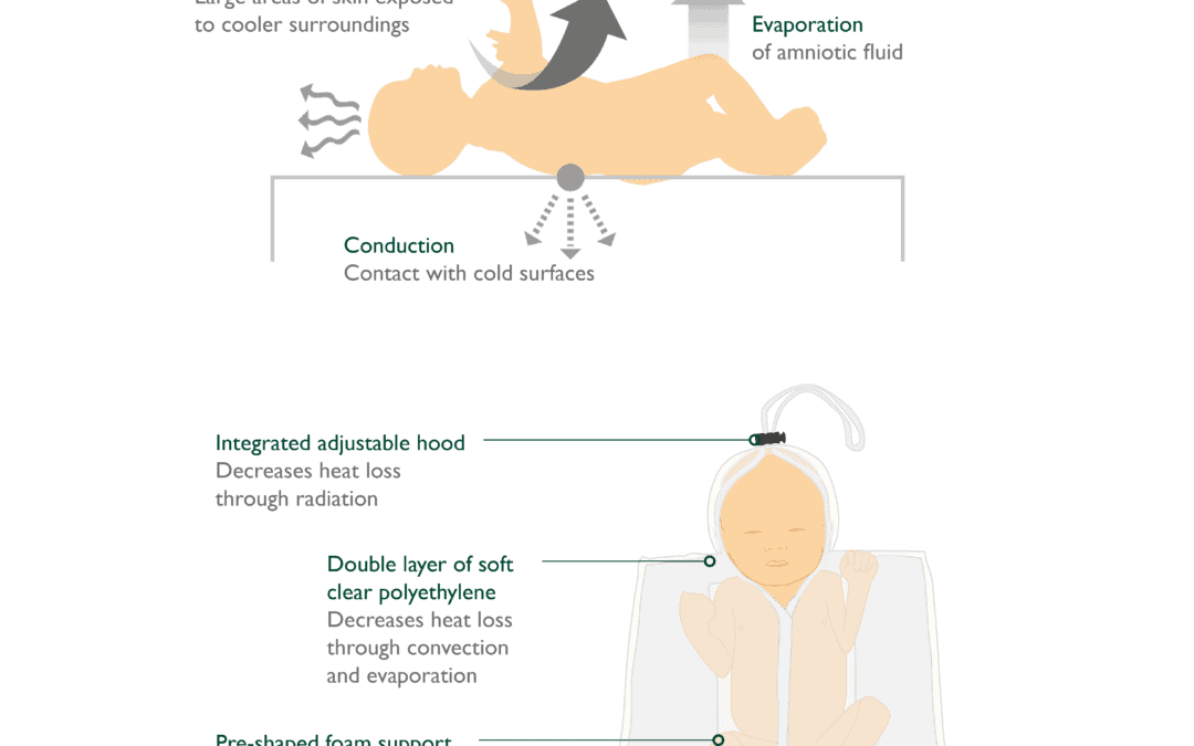The Four Pathways of Heat Loss in Pre-Term Infants