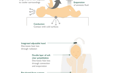 The Four Pathways of Heat Loss in Pre-Term Infants