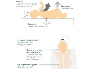 The Four Pathways of Heat Loss in Pre-Term Infants