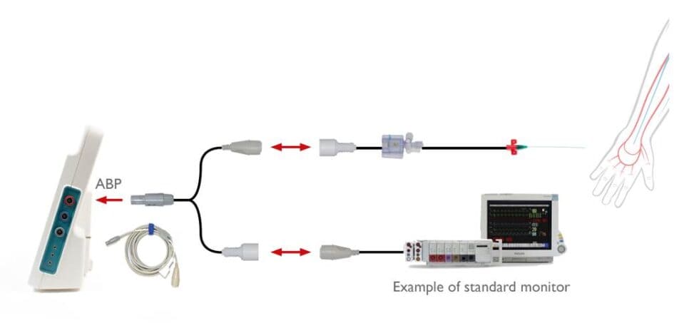 Output Monitor Advanced Setting Up Advanced Cardiac Output Monitors - Made Simple - Campus Vygon UK
